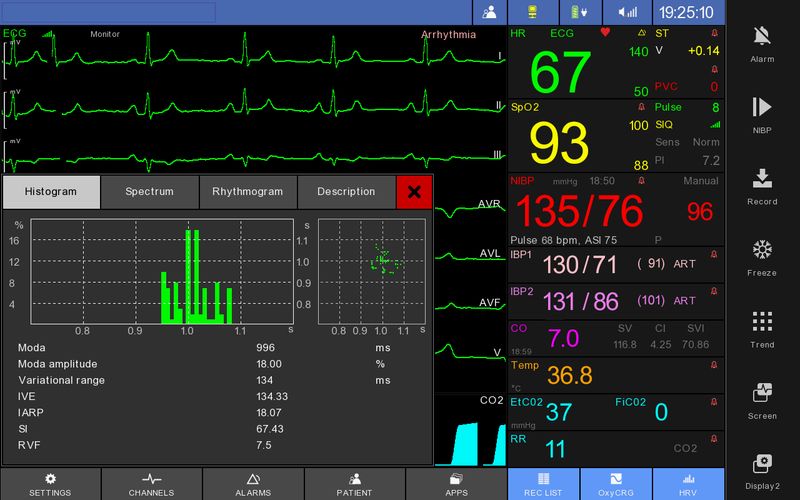 MON710_HRV_ENG_var1